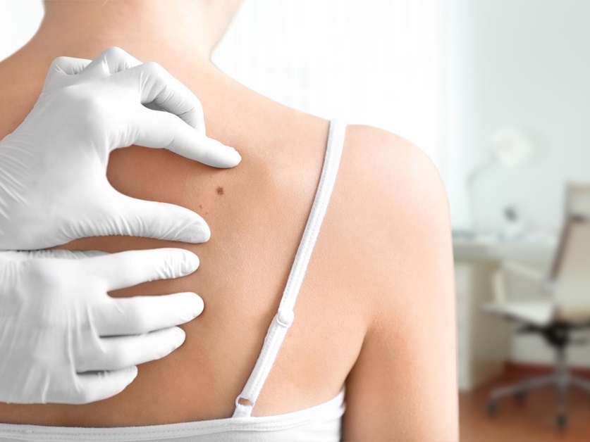 Kožní ambulance - MUDr. Bohumila Michalová